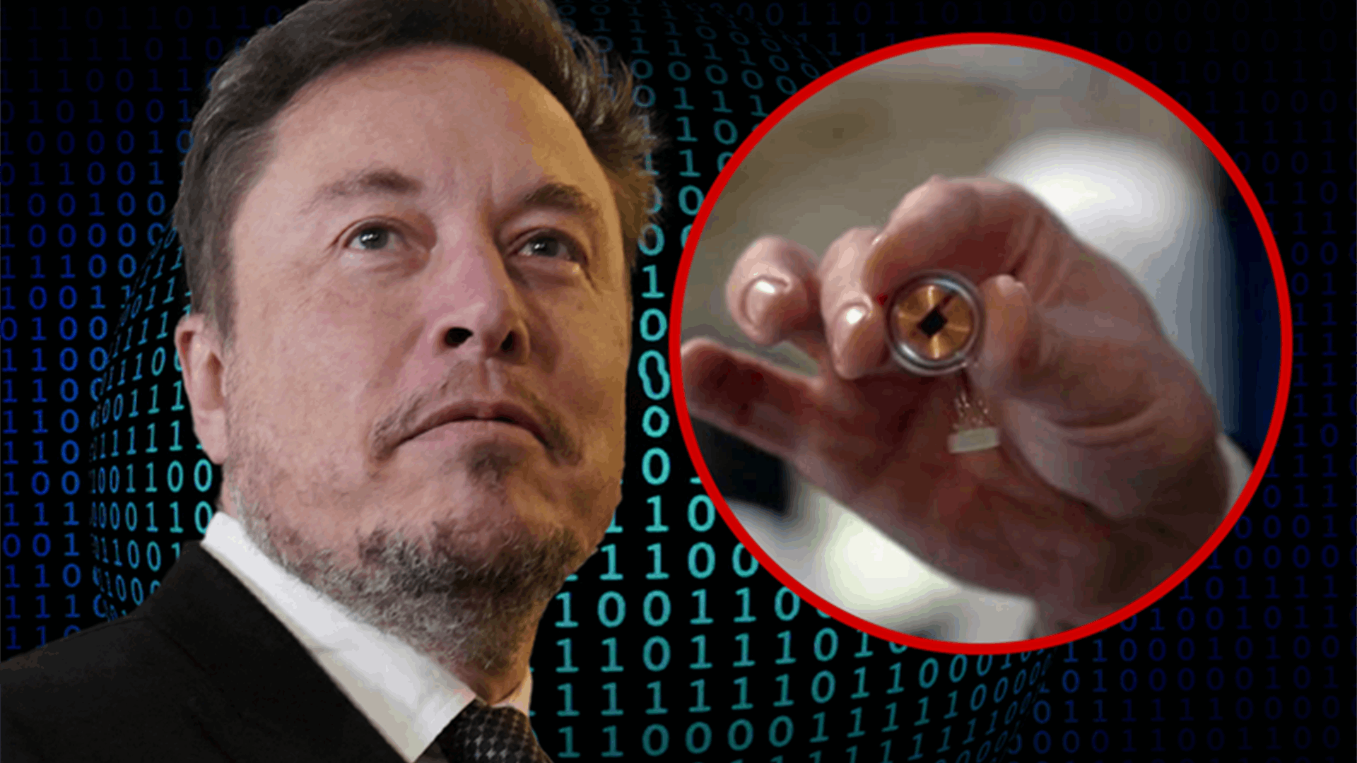 إيلون ماسك يكشف عن زراعة أول