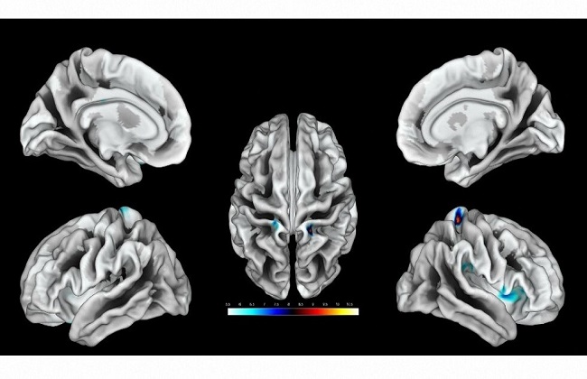 دراسة علمية تكشف أن الموت ليس